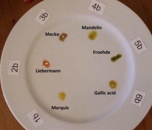 Dibutylone results